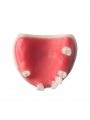 Dental Teeth Upper Jaw Missing ModelEASYINSMILE Missing  Missing the 2,3,5,6,7 on the left and the 1,5,6 on the right Model