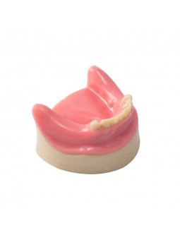 Dental Lower Jaw Teeth Missing Demonstration Model & 8 teeth  with Gum EASYINSMILE 