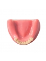 Dental Lower Jaw Teeth Missing Demonstration Model & 8 teeth  with Gum EASYINSMILE 