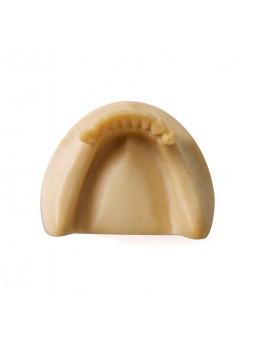 Dental Lower Jaw Teeth Missing Demonstration Model & 8 teeth  Without Gum EASYINSMILE