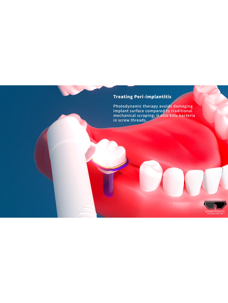 New Easyinsmile Dental Photodynamic Therapy Red Light Multi Treatment