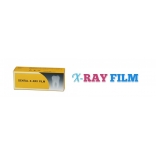 Filme raio-x dentários|filme para raio-x dental|Filme para Raio-X Odontológico|Filme RX Radiográfico 